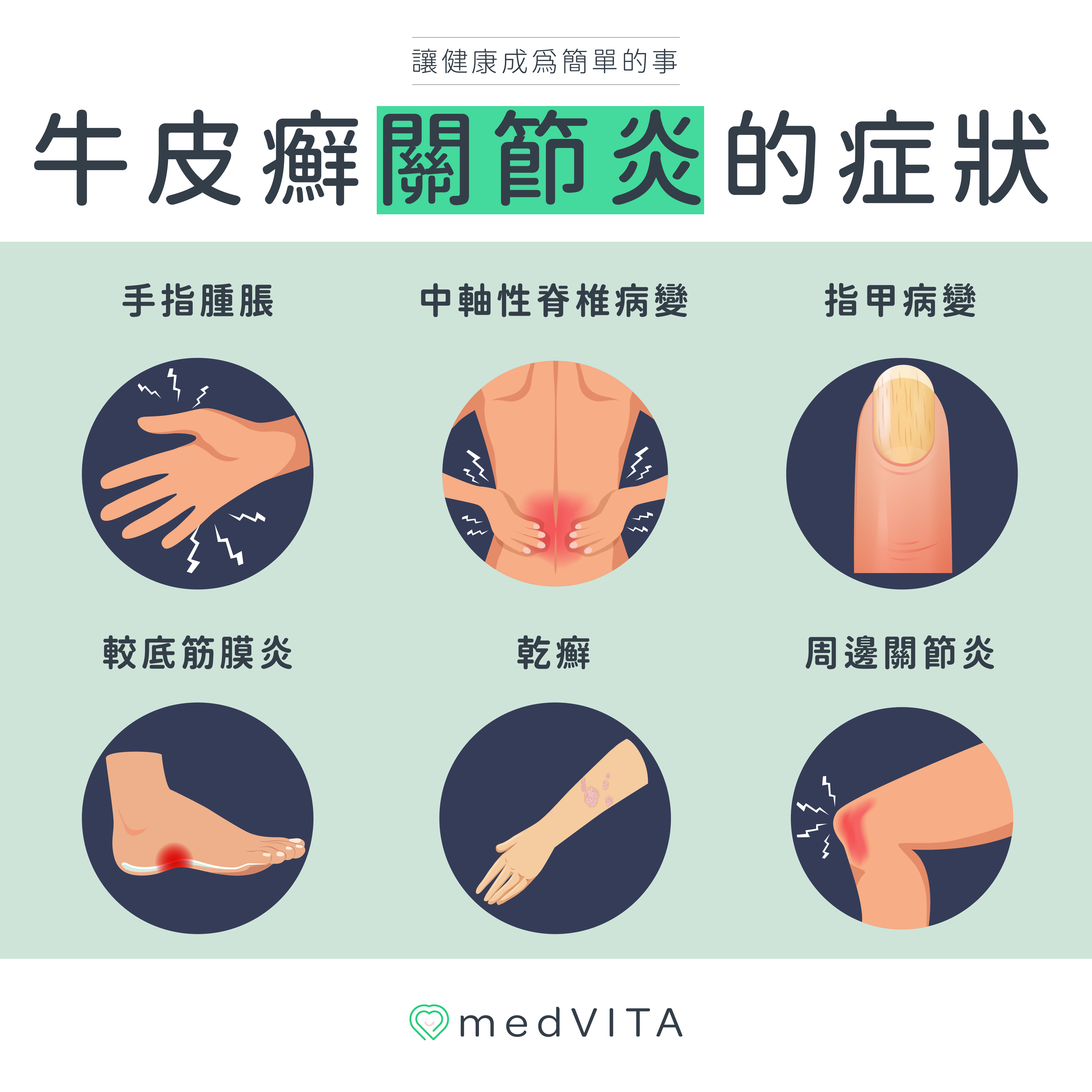 覺㦡medVITA | 牛皮癬關節炎的症狀