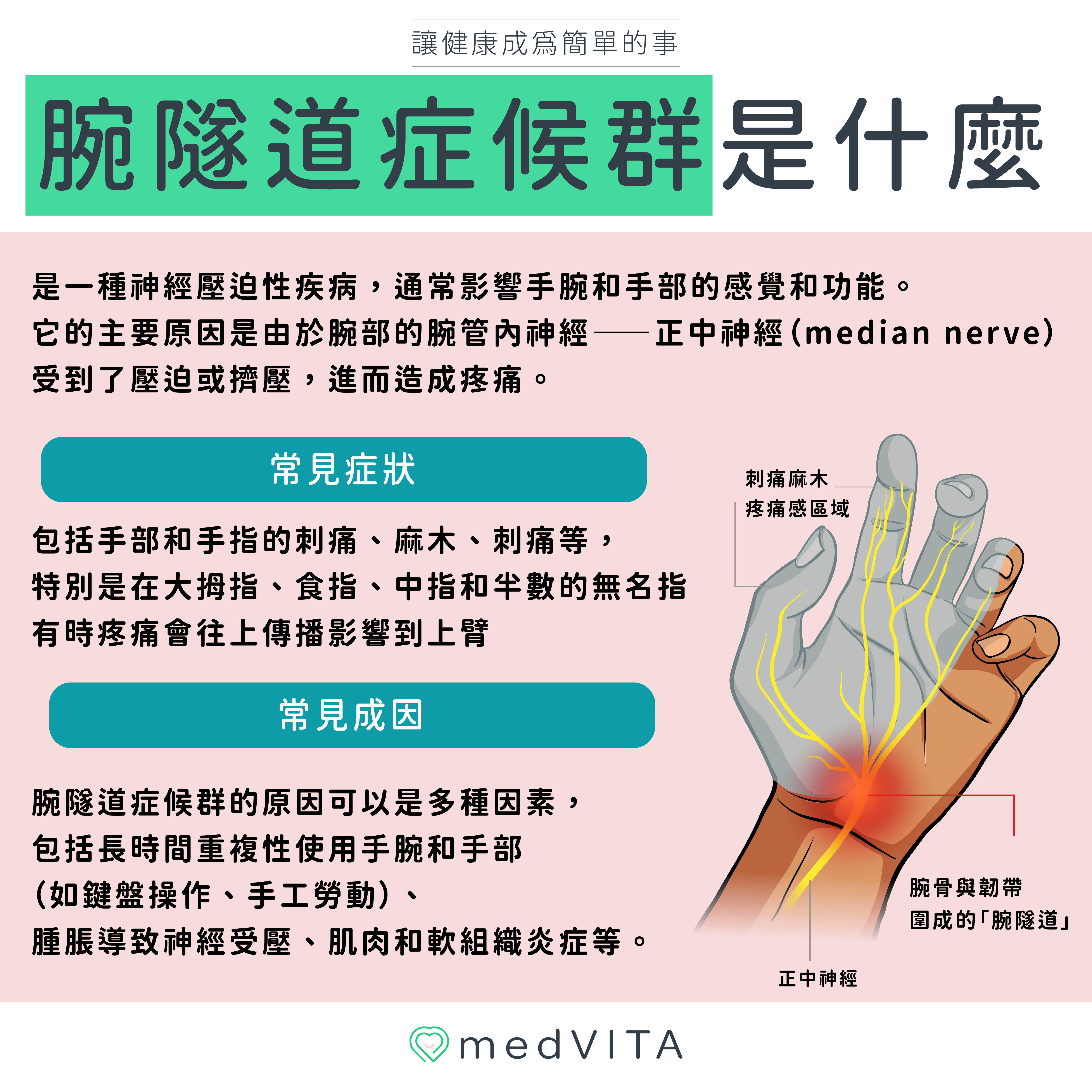 覺㦡medVITA | 腕隧道症候群是什麼