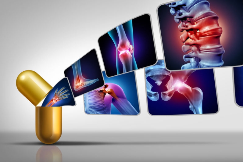 葡萄糖胺/Glucosamine 與退化性關節炎