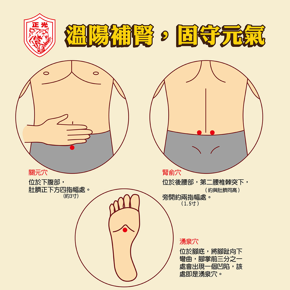 一張標題為「溫陽補腎,固守元氣」的穴位圖,由正光品牌製作。圖中展示了三個穴位的位置: 關元穴: 位於下腹部,肚臍正下方四指幅處。 腎俞穴: 位於後腰部,第二腰椎棘突下,旁開約兩指幅處。 湧泉穴: 位於腳底,腳掌前三分之一處的凹陷處。