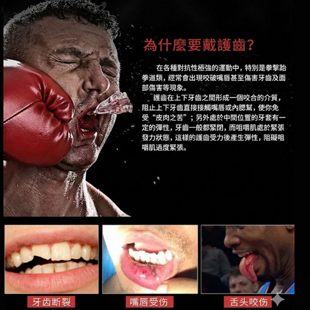 ~子甄彣璟~專業運動牙套 護齒 牙托 食品級 EVA 運動防護 獠牙吸血鬼牙套 籃球 拳擊 格鬥護齒 防撞耐磨6