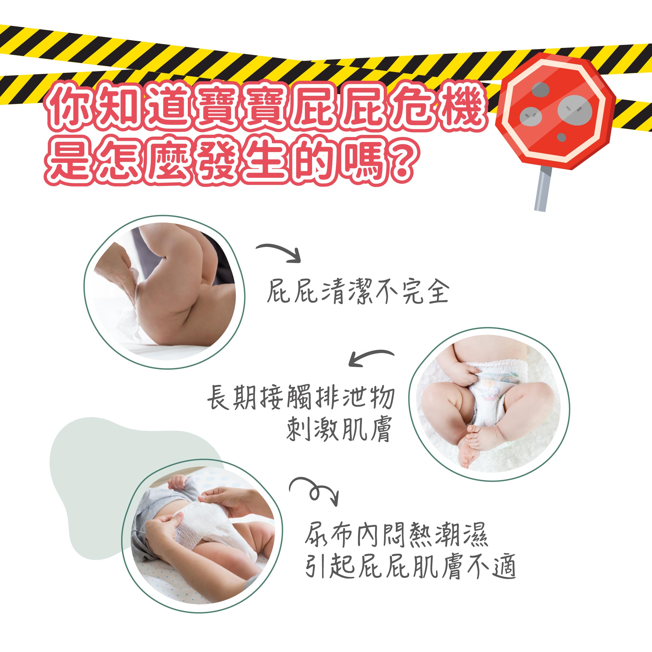 2025_7_Derma Baby_乾洗屁屁-05.jpg