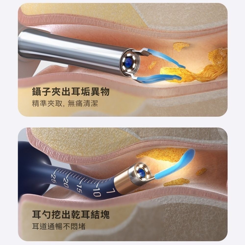 【Bebird ADAM 3 Ultra】隨身多功能配件盒豪華版(口腔/鼻內/耳內/擠痘棒)13