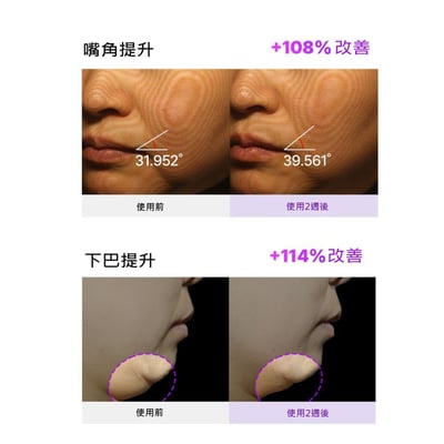 【iMeuu愛美悠】BIOHEAL BOH 3D全臉提拉面膜5片入 緊緻 雙下巴 輪廓線 下顎線 凝膠面膜8