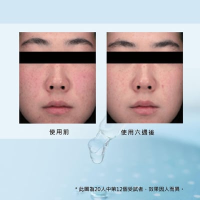 【iMeuu愛美悠】Dr. Belmeur肌本博士淨膚調理舒緩精華22ml(1+1雙瓶組)敏弱肌 溫和 光滑3