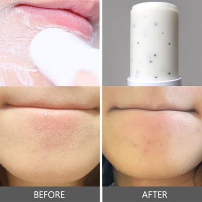 Milk Touch白頭粉刺清除洋甘菊泥棒4