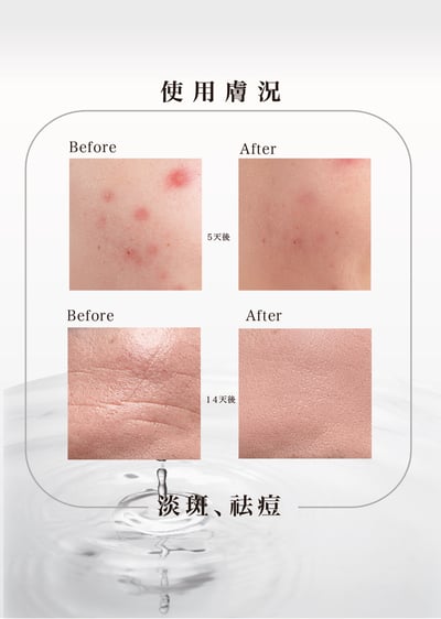 現貨｜LUMIRA KIRA未來之耀外泌體 全效鎖水煥顏凝露6