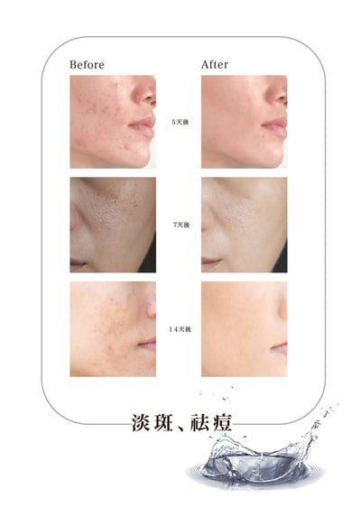 現貨｜LUMIRA KIRA未來之耀外泌體 全效鎖水煥顏凝露7