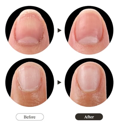 Withshyan 極萃紅蔘護甲指緣油 15ml3