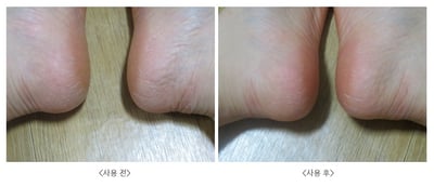 韓國一刮就掉腳皮刀3