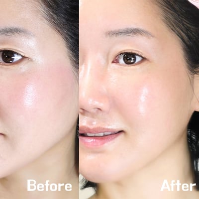 張員瑛同款 medicube AGE-R Booster Cleanser 二合一洗臉機『8/10結單』6