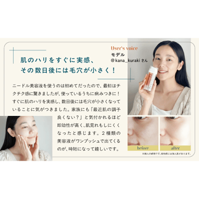 【 NOWL 】20萬本塗抹式微針雙效精華7