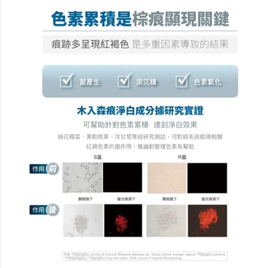 木入森MORESON 痕淨白(眼睛保健食品)5