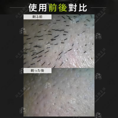 日本KAI貝印－Xfit 5刀刃 刮鬍刀5