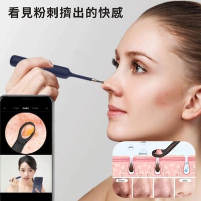 【Bebird ADAM 3 Ultra】隨身多功能配件盒豪華版（口腔/鼻內/耳內/擠痘棒）15