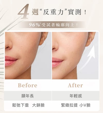 Volta繃繃棒 6D超微電溫感緊緻美容儀 (白色/黑色)12