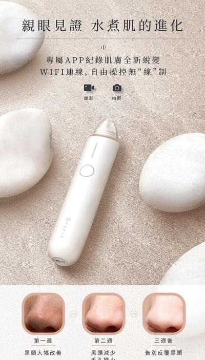 【Nueva】Aurora™ 小極光 HD高解析粉刺機5