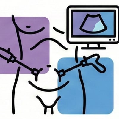 腹股溝疝氣專業評估1