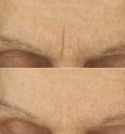 加拿大代購｜ROC 極致保濕面霜 50ml x3入｜Maple Treats4