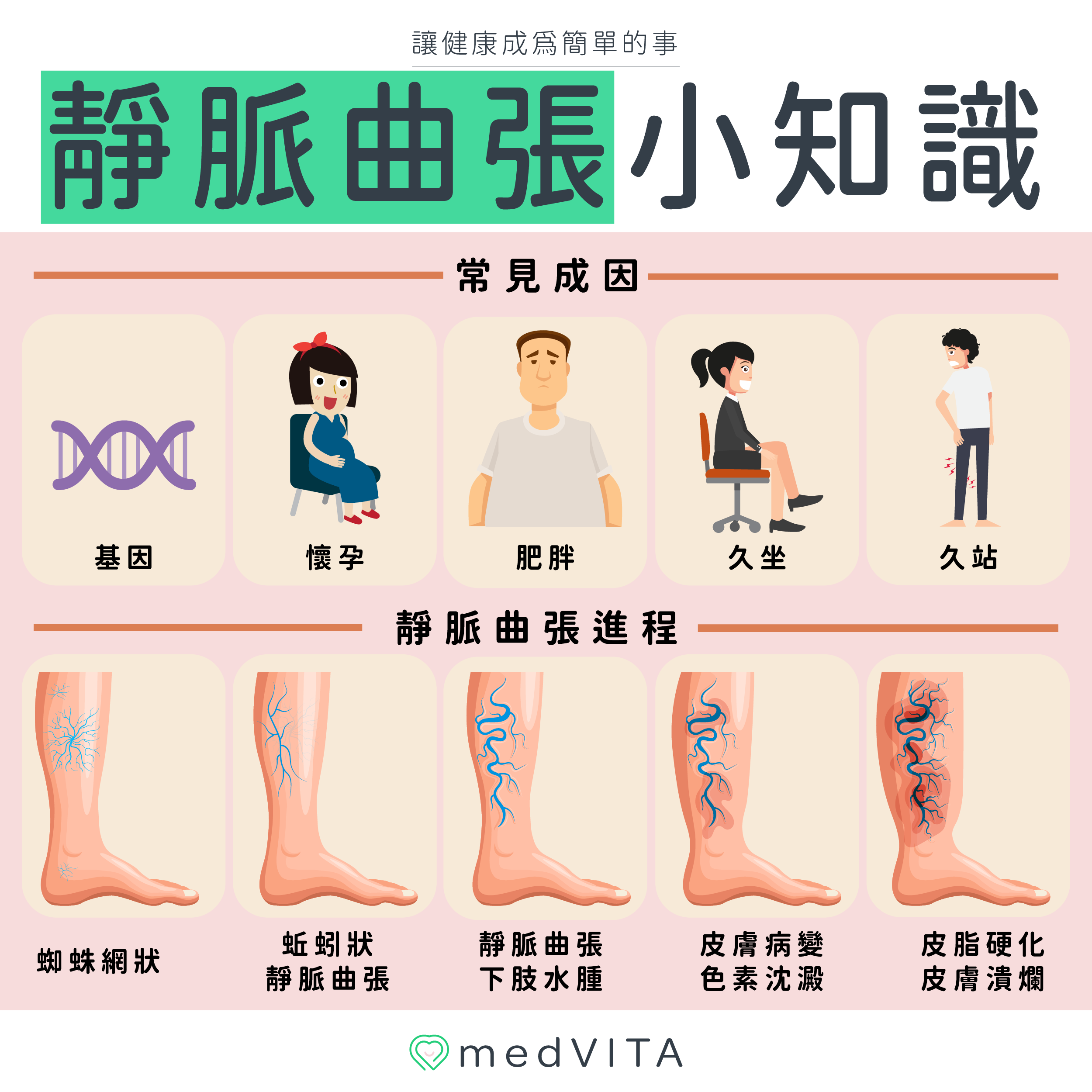 覺㦡medVITA | 靜脈曲張小知識