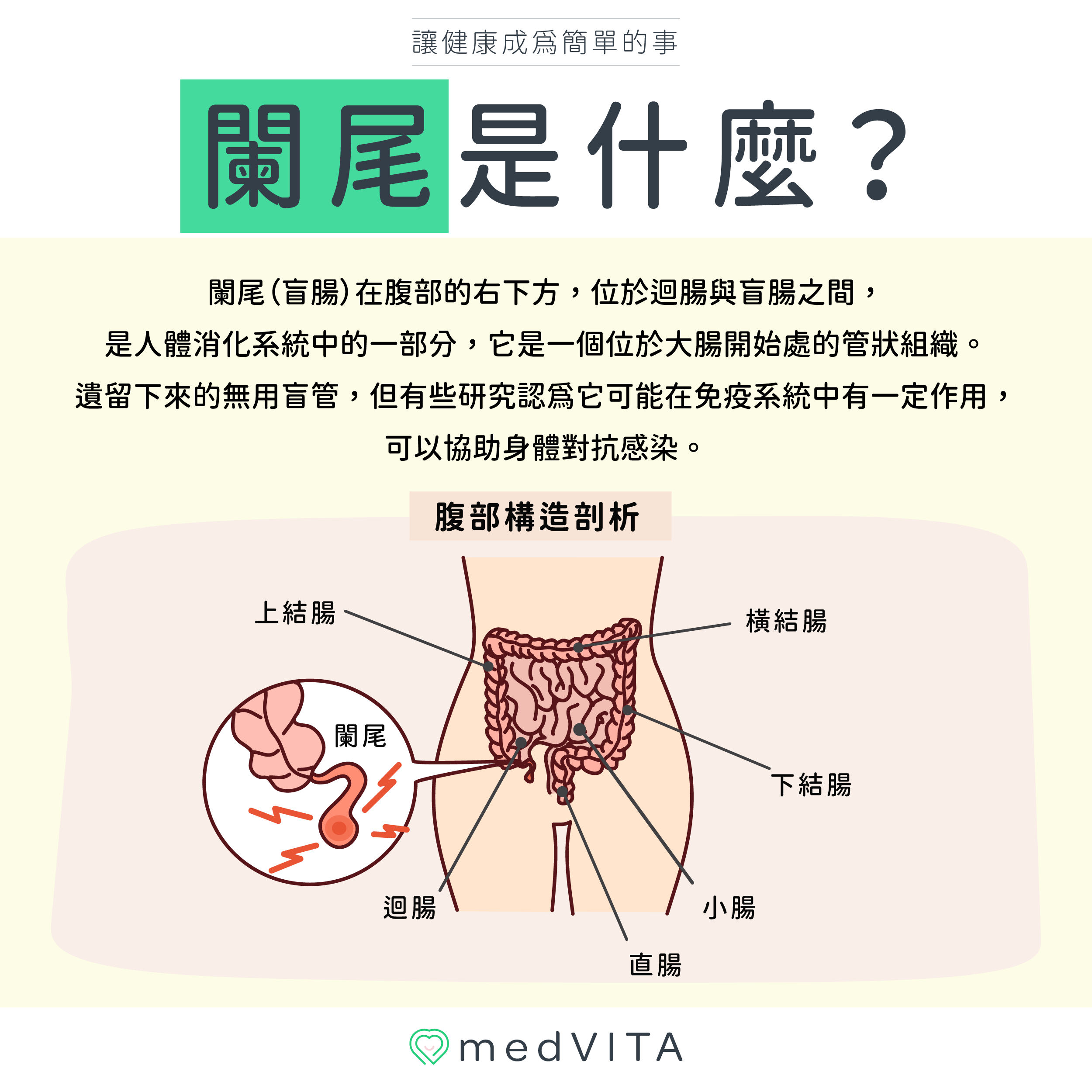 覺㦡medVITA |闌尾是什麼
