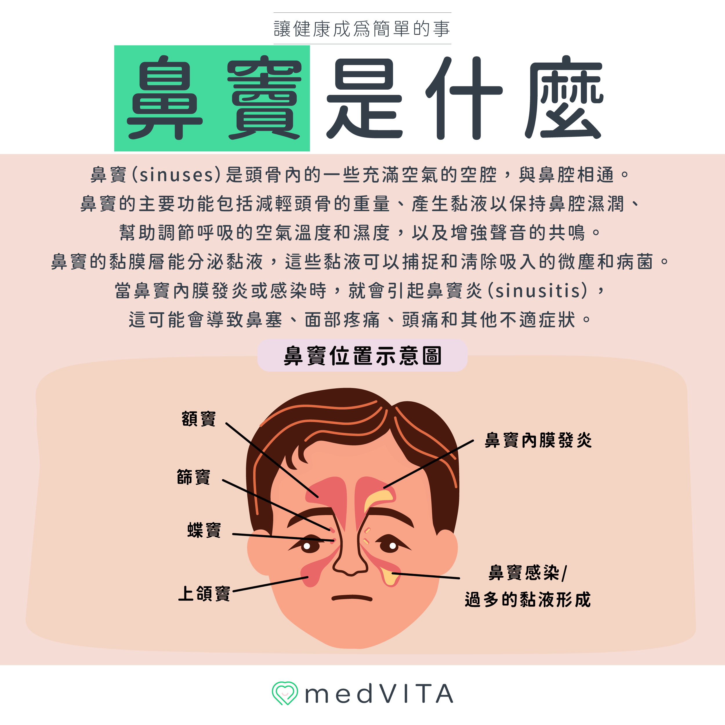 覺㦡medVITA | 鼻竇是什麼