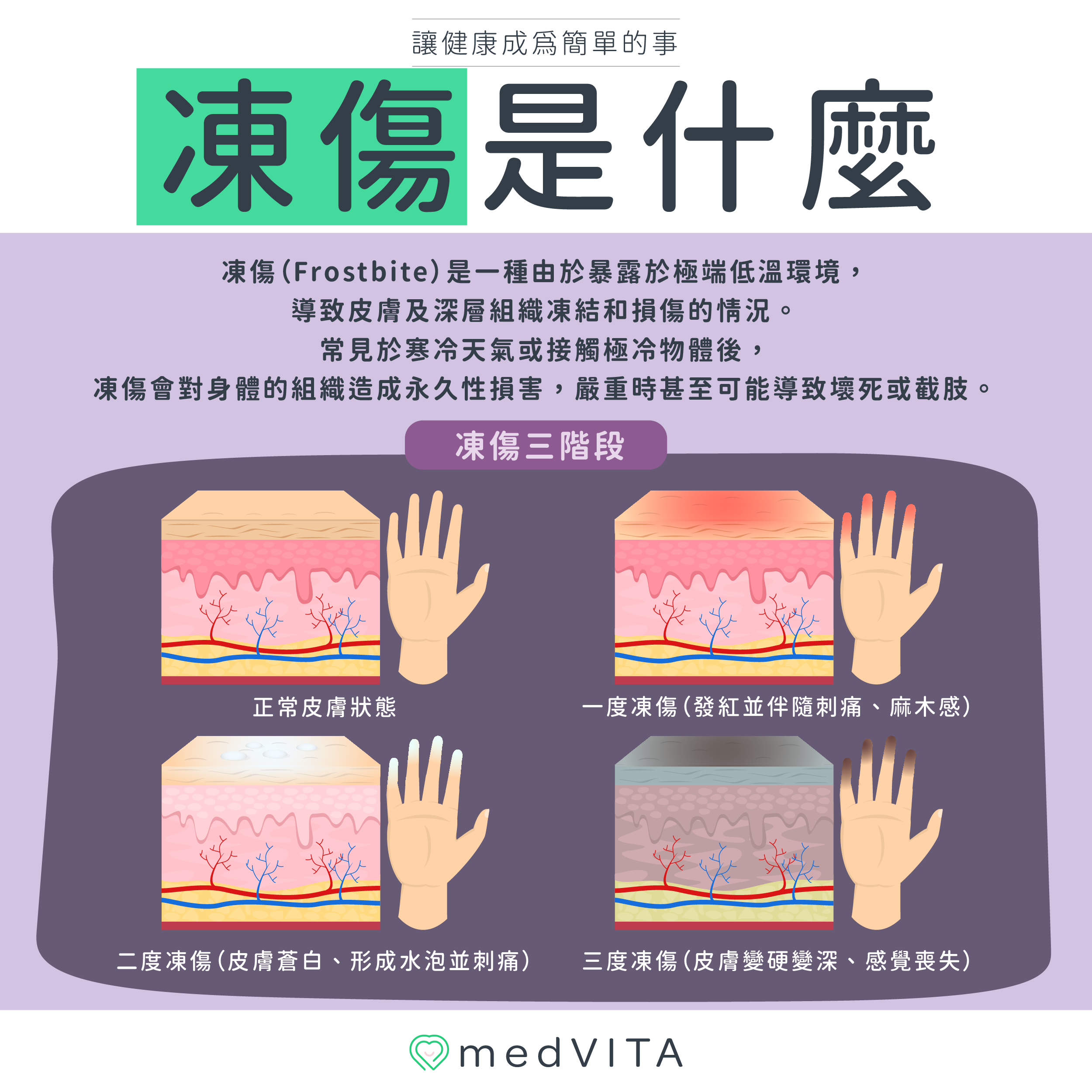 覺㦡medVITA | 凍傷是什麼