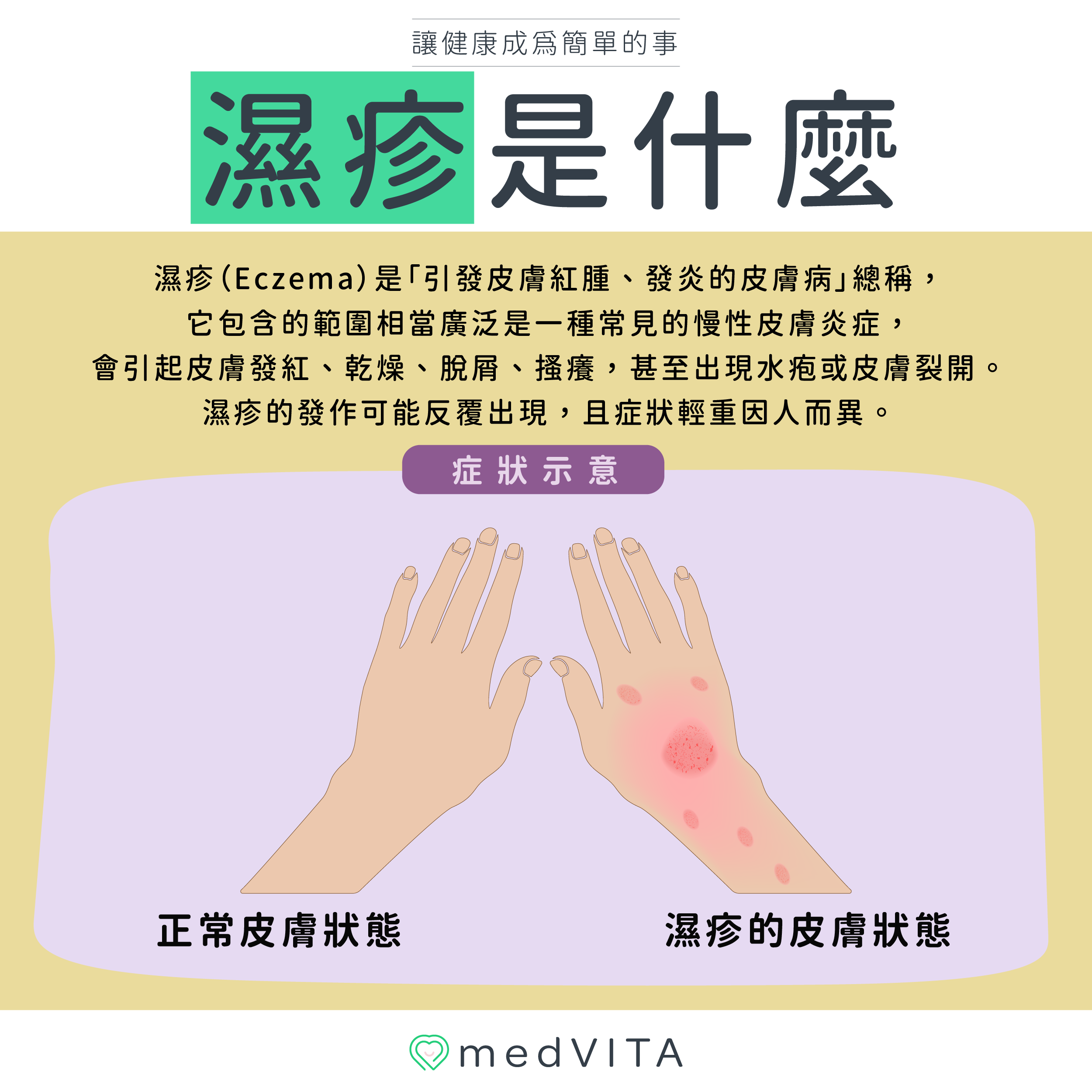 覺㦡medVITA | 濕疹是什麼