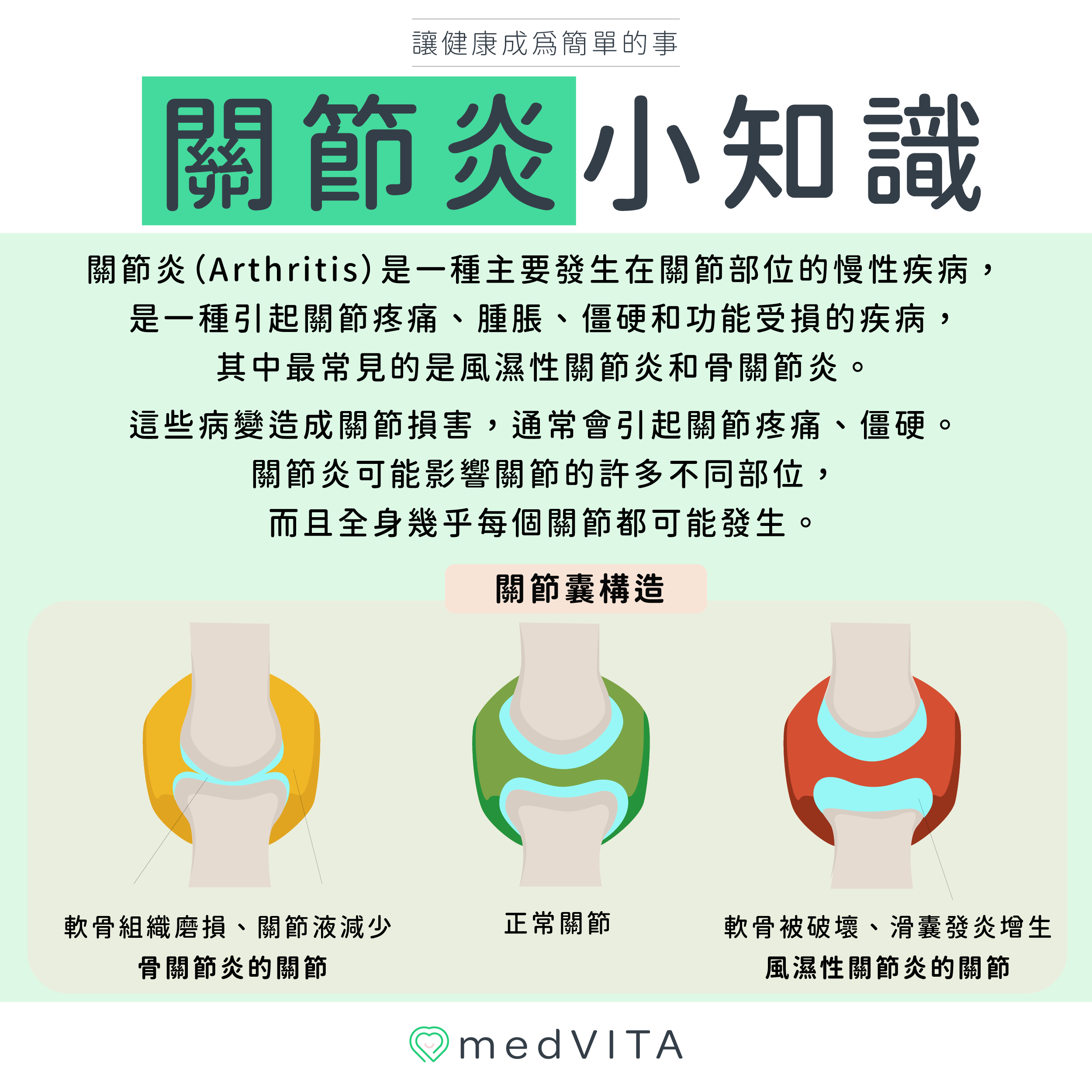 覺㦡medVITA | 關節炎是什麼