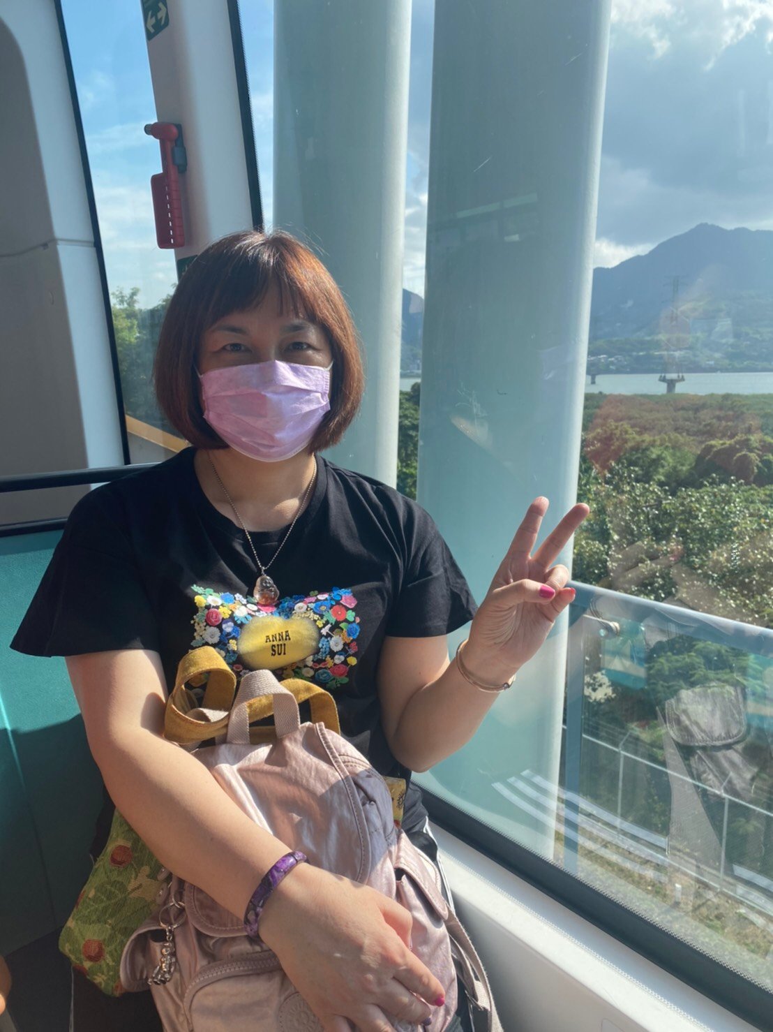 北市徐小姐：使用1個月時，足底結膜炎比較不疼痛，可以走比較遠的路程！