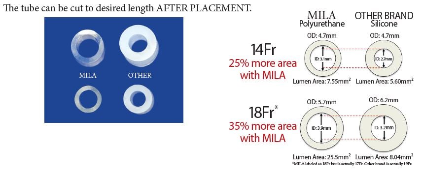 Length-Adjustable Esophagostomy Feeding Tubes