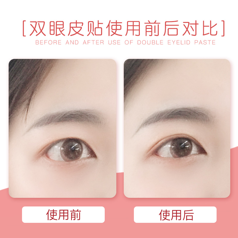 日本LUCKY－膚色網狀雙眼皮貼（30回／附棒子）