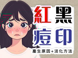 紅黑痘印
