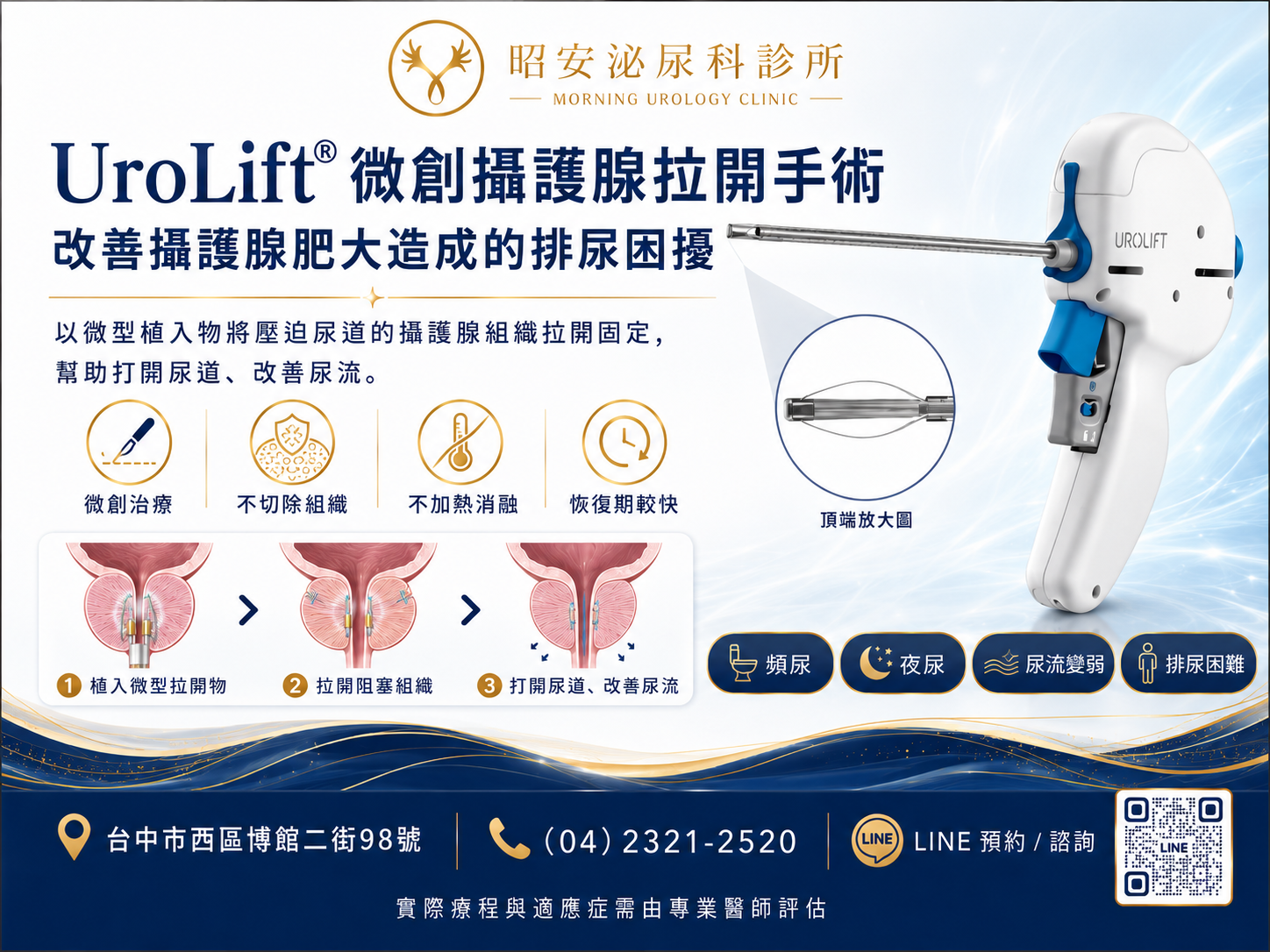 爸爸晚上一直跑廁所？泌尿科醫師：UroLift微創攝護腺拉開手術，免切割快速恢復｜泌尿科推薦