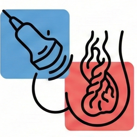 靜脈管徑組織｜專業精準流程