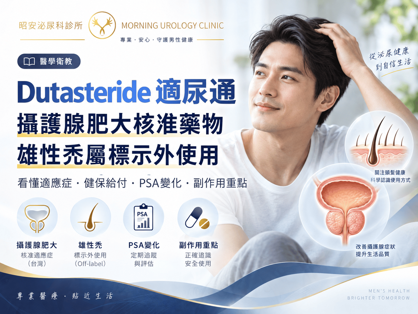 Dutasteride（如同市面上常見的適尿通）台灣核准的是攝護腺肥大，雄性禿屬標示外使用：副作用、PSA 與捐血備孕限制｜台中昭安泌尿科