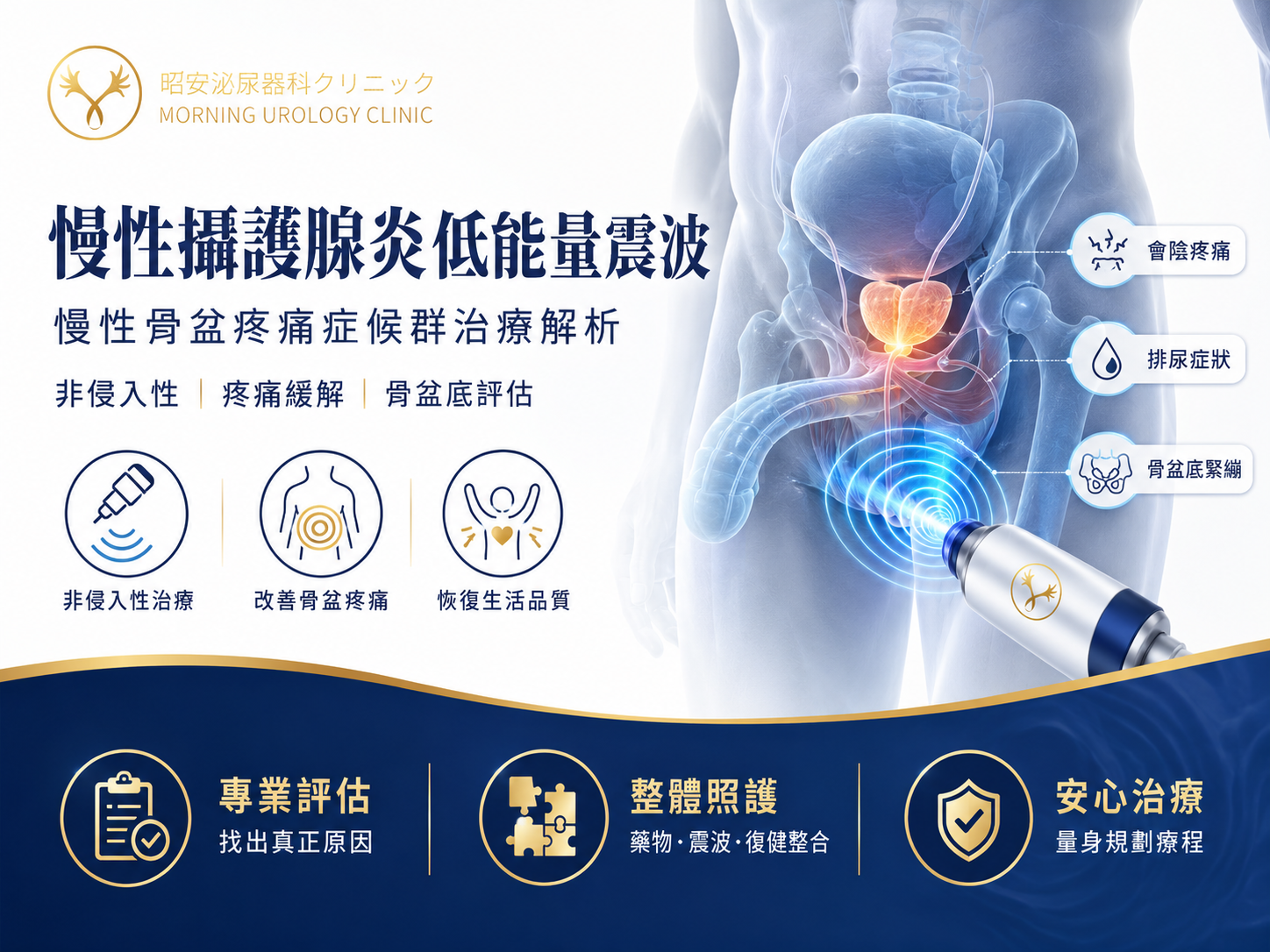 慢性攝護腺炎一直好不了？泌尿科醫師解析低能量震波效果、療程與副作用