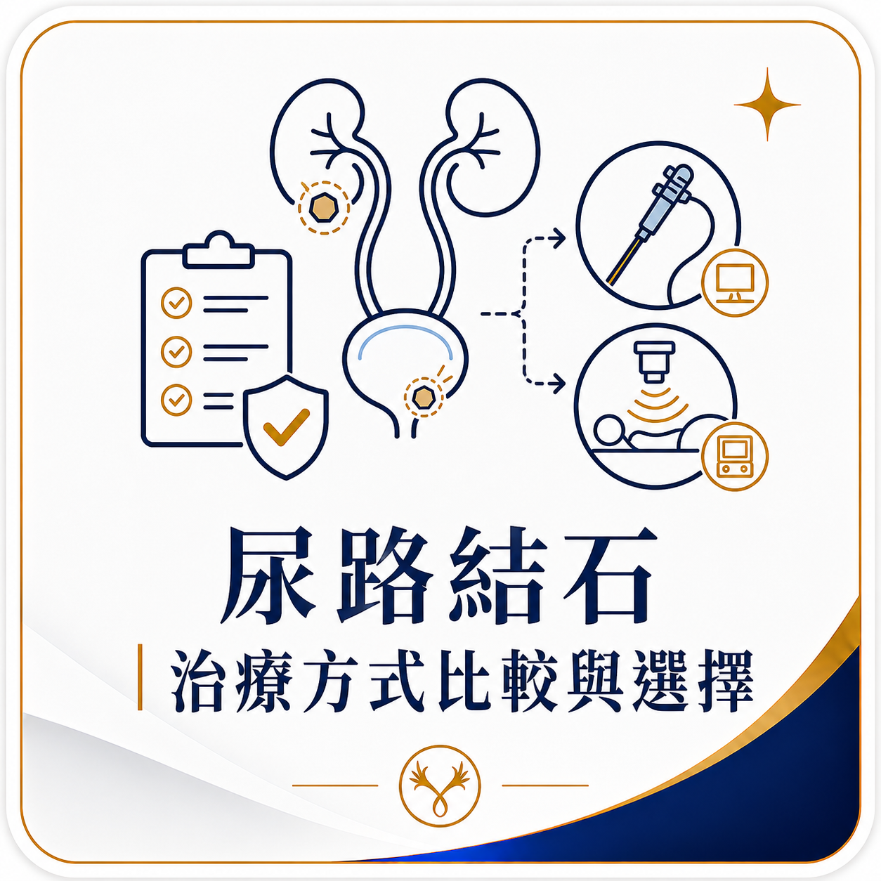 尿路結石｜治療方式比較與選擇