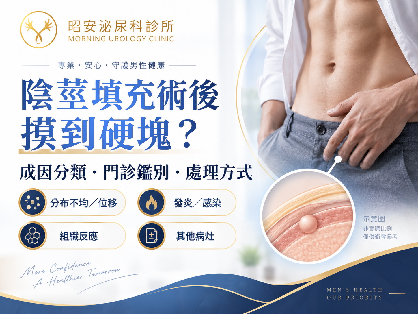 陰莖填充術後摸到硬塊怎麼辦？成因分類、門診鑑別與處理方式｜台中昭安泌尿科
