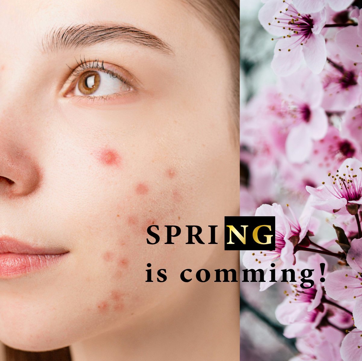 春天4大NG警報   拒當花花臉