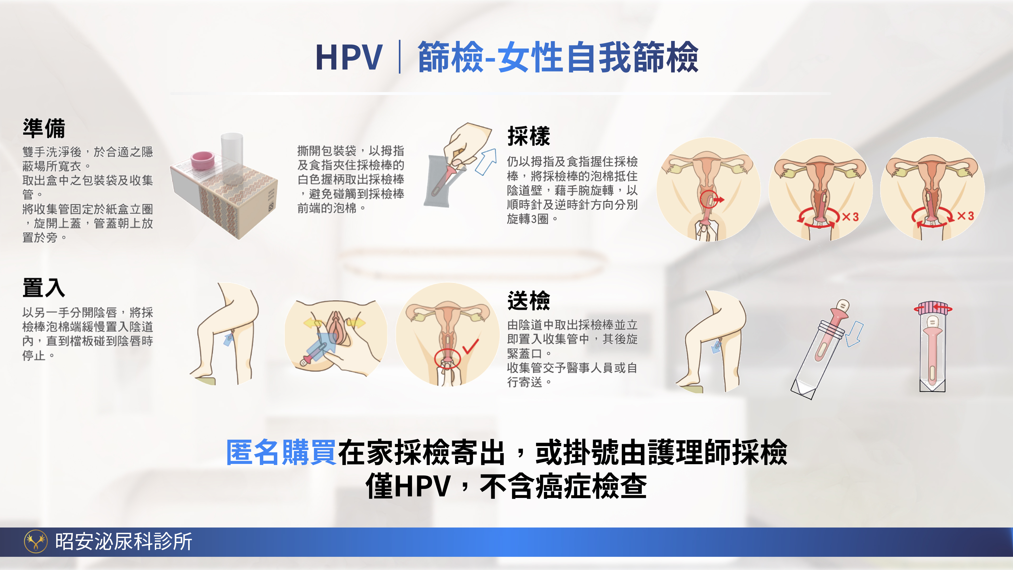 女性HPV匿名自我採檢試劑-在家輕鬆完成隱私篩檢 昭安泌尿科診所推廣女性 HPV 匿名自我採檢試劑 (HygeiaTouch)。主打私密、便利,在家也能安心完成。具備匿名採檢、完整隱私、簡單方便、省時免奔波四大特色。臨床試驗顯示使用滿意度超過90%,99%受試者認為採檢安全。圖解四個簡易步驟:準備、置入、採樣、送檢,提供女性體貼的子宮頸防護新選擇。