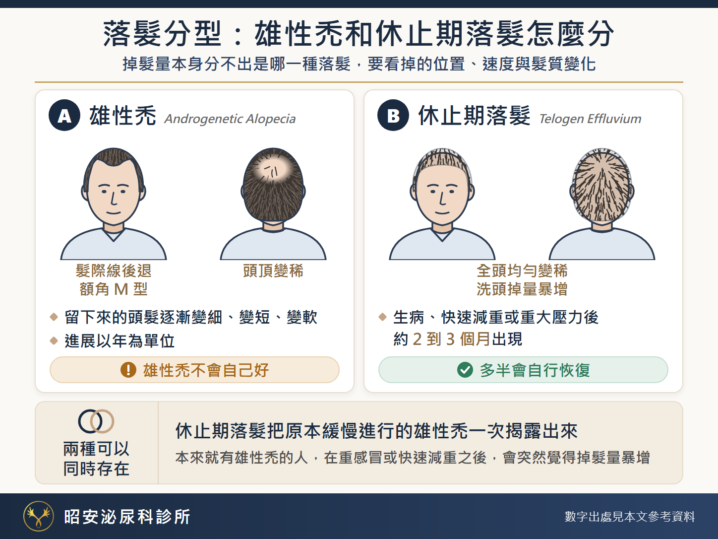 落髮分型:雄性禿和休止期落髮怎麼分 落髮分型說明圖。A 雄性禿(Androgenetic Alopecia):正面示意圖是髮際線後退、額角 M 型,背面示意圖是頭頂變稀;留下來的頭髮逐漸變細、變短、變軟,進展以年為單位;雄性禿不會自己好。B 休止期落髮(Telogen Effluvium):正面與背面示意圖都是全頭均勻變稀、洗頭掉量暴增;生病、快速減重或重大壓力後約 2 到 3 個月出現,多半會自行恢復。兩種可以同時存在:本來就有雄性禿的人,在重感冒或快速減重之後,會突然覺得掉髮量暴增,那是休止期落髮把原本緩慢進行的雄性禿一次揭露出來。