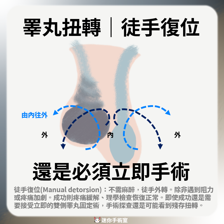 睪丸扭轉的徒手復位方向由內往外，即使成功仍必須接受立即手術