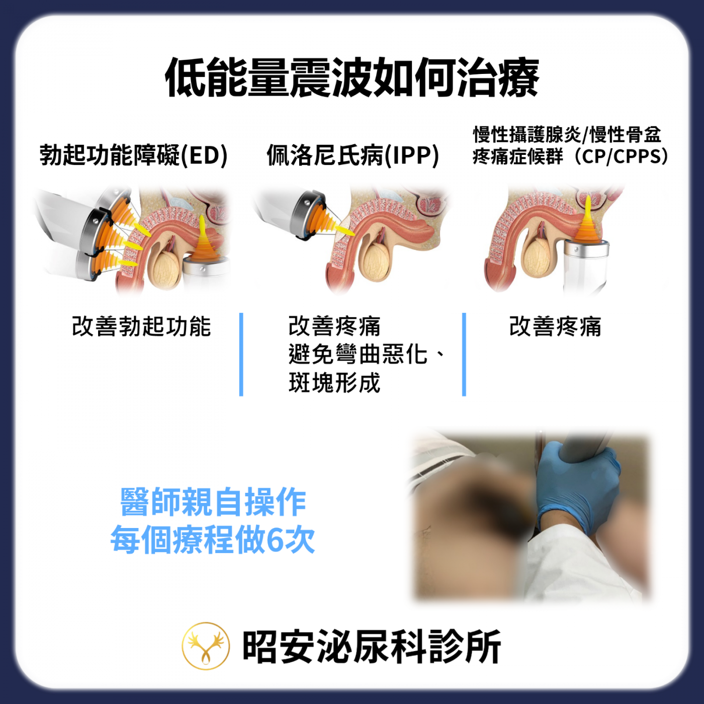低能量震波適應性與風險衛教